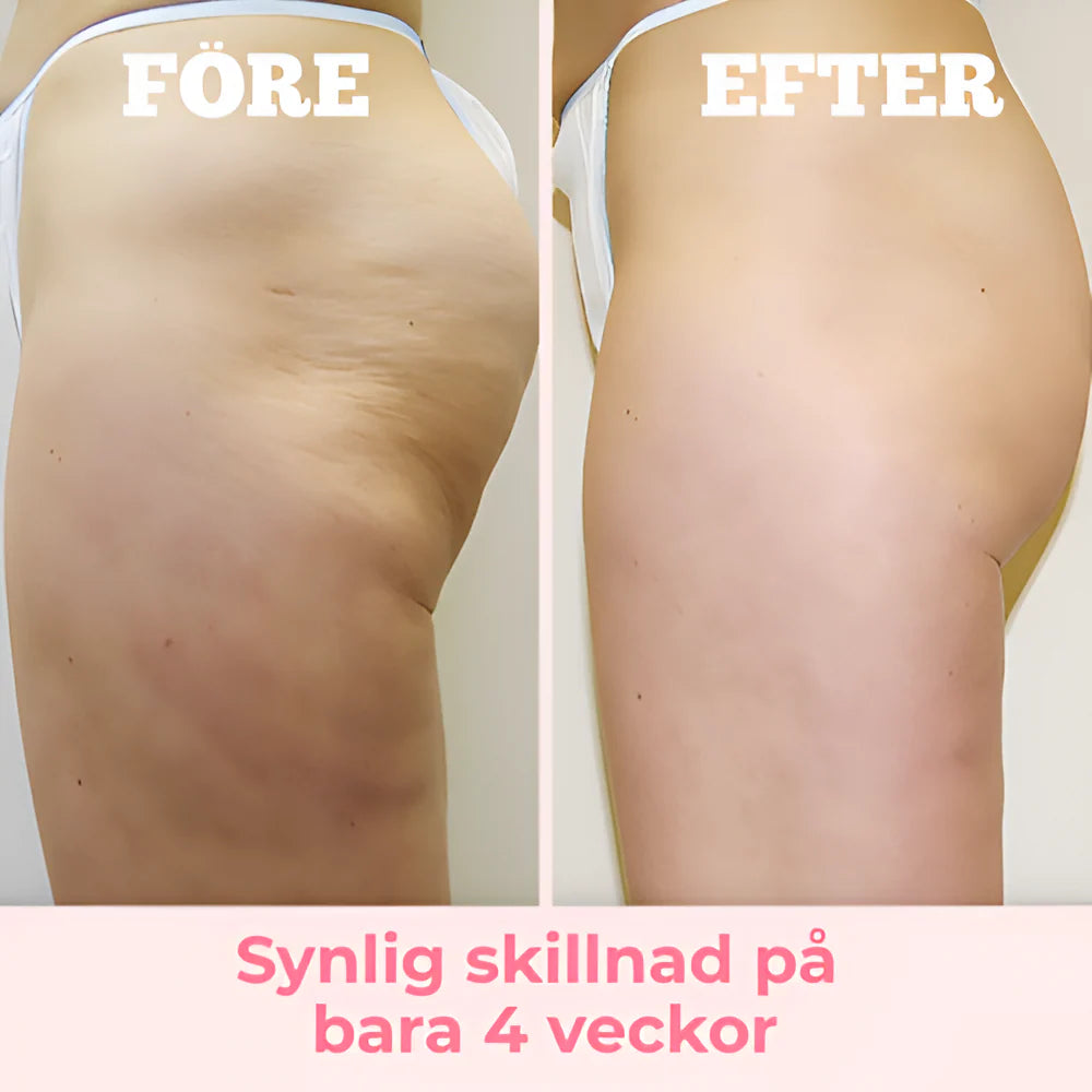 Anti-Cellulit Roller™ - Slät hud på nolltid!